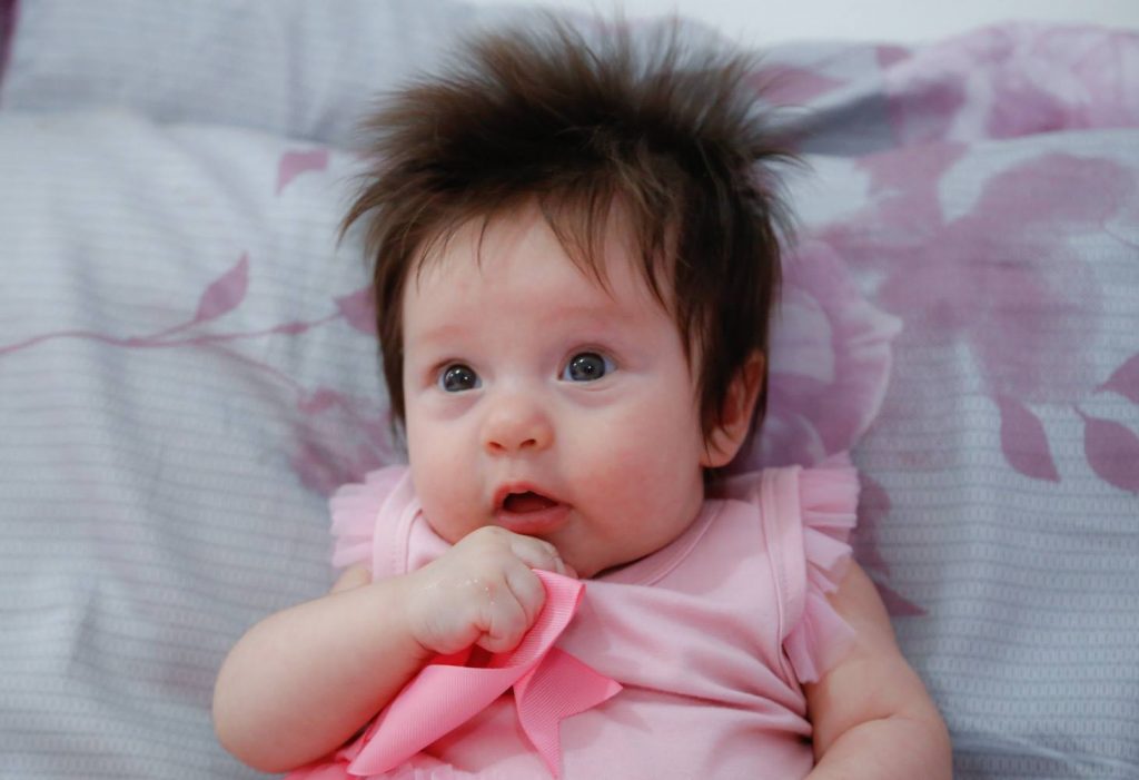 bebes cabeludos 44 0 Afinal, como serão os bebês geneticamente modificados? bebes cabeludos 44 0